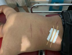 Beberapa Pemuda Asik Pesta Miras di Polewali Diserang Oleh OTK  Dengan Sajam, Tiga Handphone Raib 